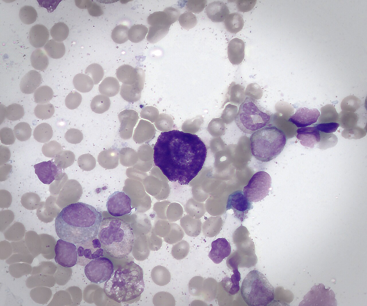 Mast cell